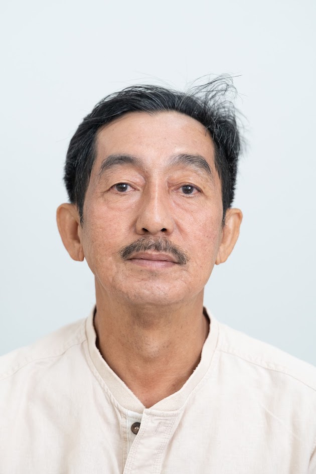 Acne Scar Treatment - After