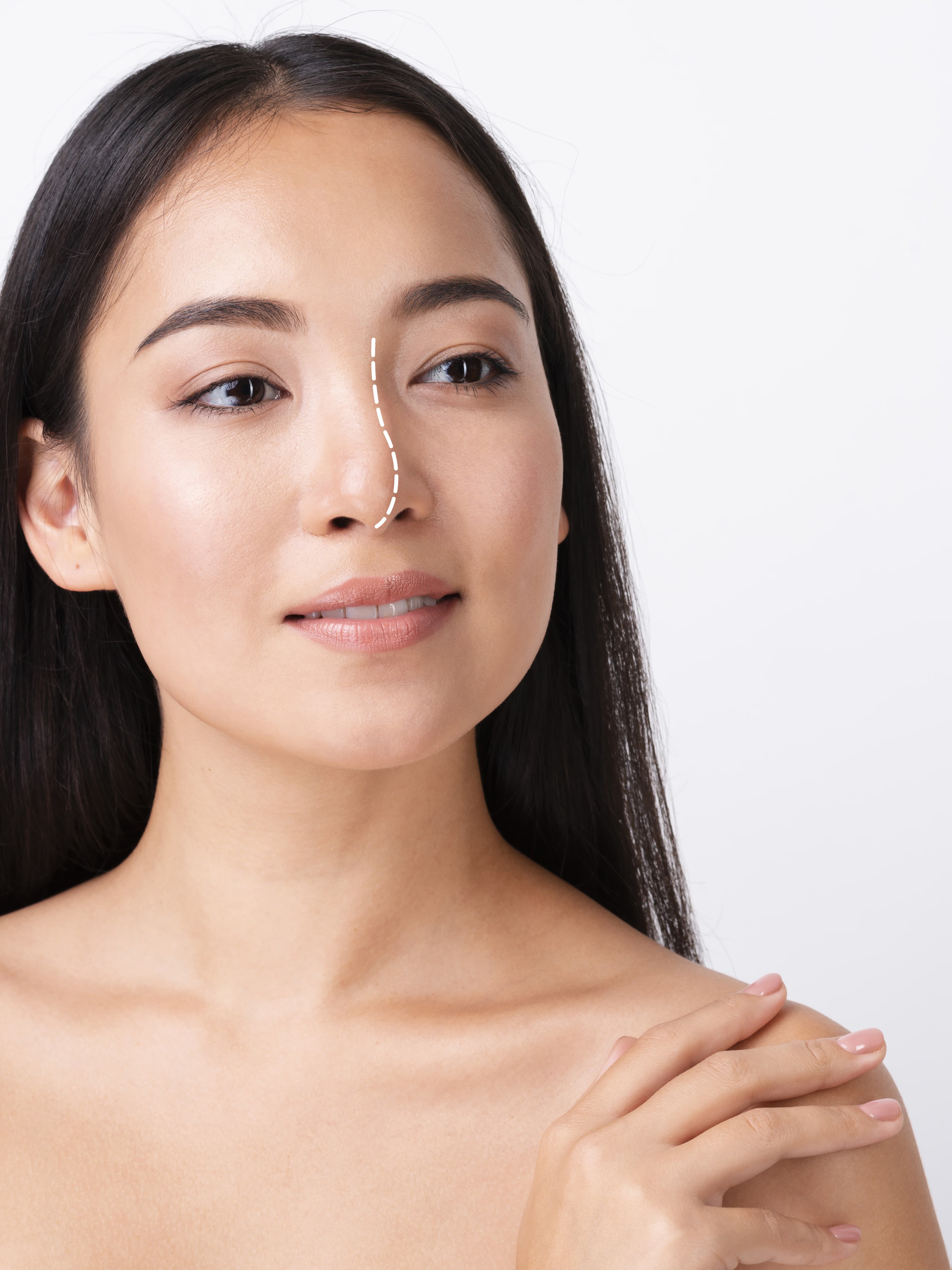 Skin Rejuvenation - Before