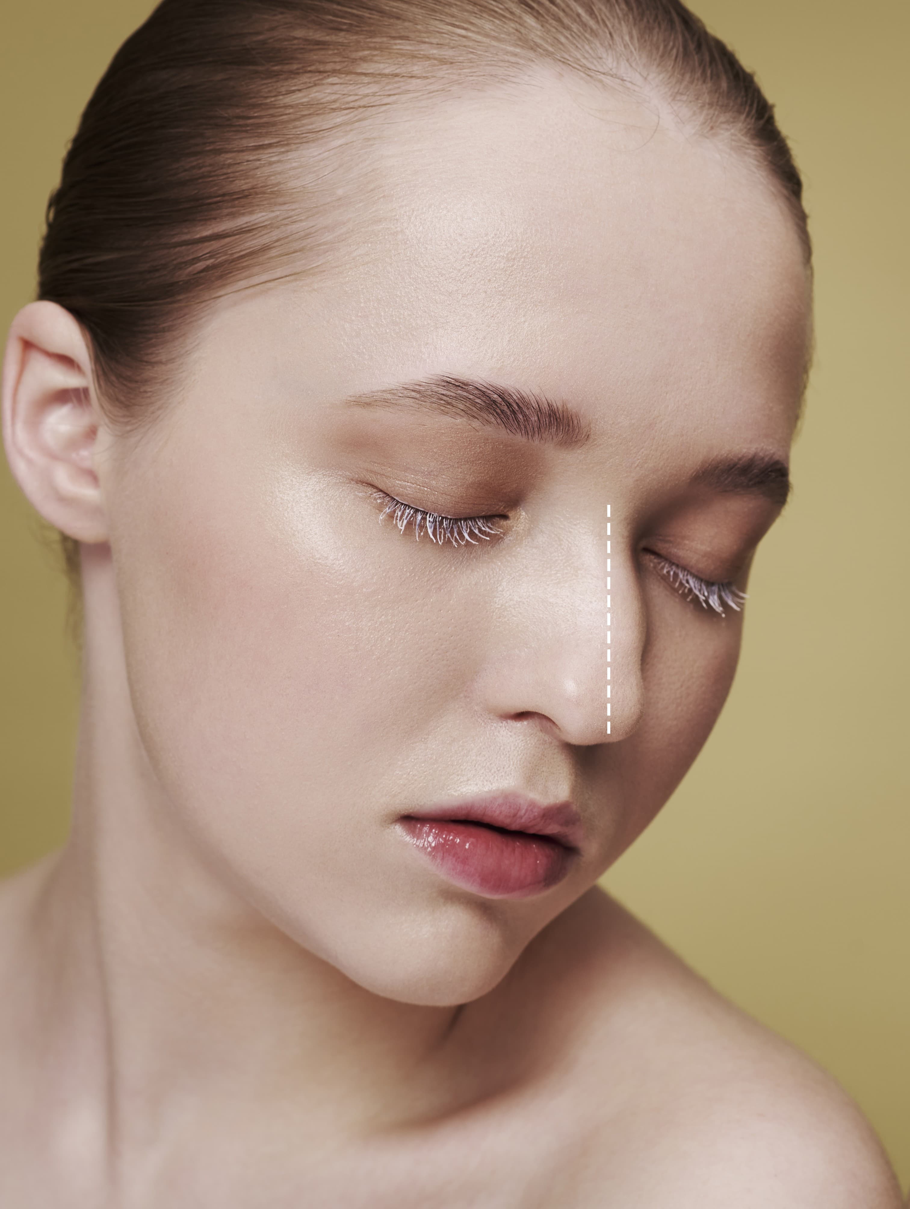 Volume Loss - Before