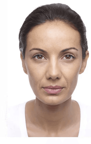 Volume Loss - Before